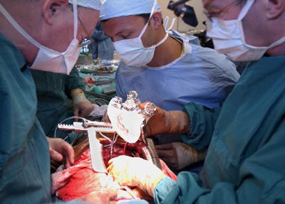 Impianto di cuore artificiale. Foto di una sala operatoria Impianto di cuore artificiale. Foto di una sala operatoria