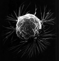 cellula tumorale