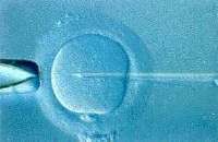 The image “http://www.bioblog.it/wp-content/uploads/2006/08/cellule_staminali_embrionali_fecondazione_in_vitro.jpg” cannot be displayed, because it contains errors.