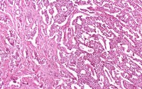 Cellule pancreatiche