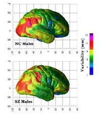 schizofrenia