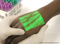 VeinViewer