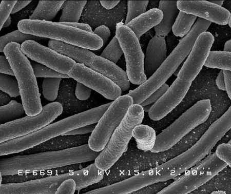 escherichia coli batterio