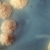 tubercolosi