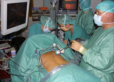 Colecistectomia per via transvaginale