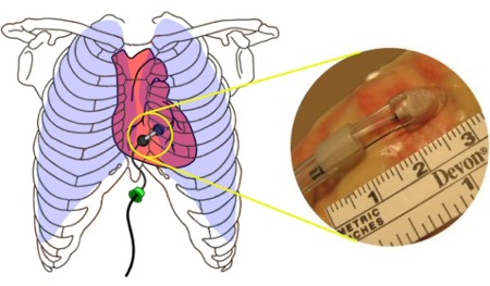 robot cuore mininvasivo
