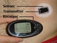 sensore diabete