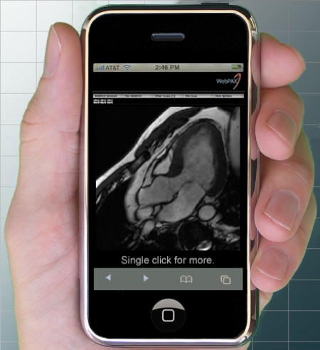 iphone immagini mediche mr