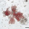 globuli rossi cellule staminali