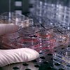 Coltura cellule staminali (University of Wisconsin-Madison)
