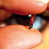 rfid microchip impiantato sotto cutaneo