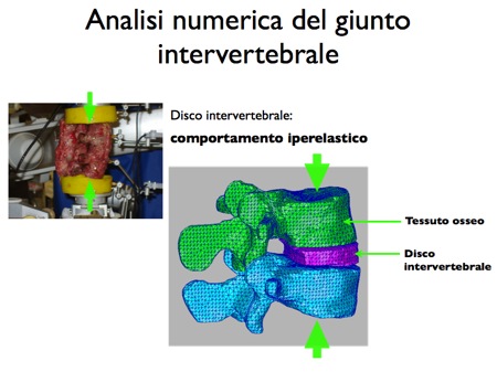 modello agli elementi finiti giunto intervertebrale