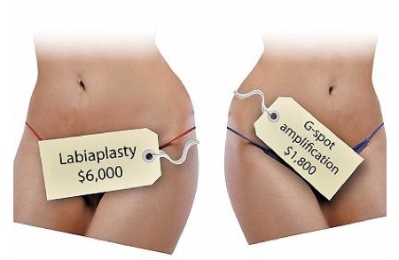 Aumento di un pene e quanto per