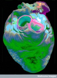 biovalvole cardiache