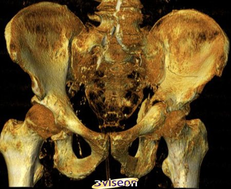 anatomia bacino anca