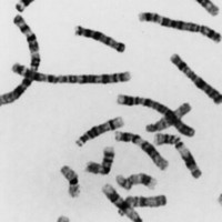 cromosoma di sintesi