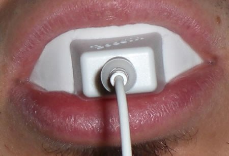 sbiancante denti bianchi