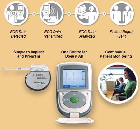 Elettrocardiogramma ECG wireless