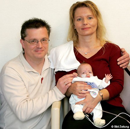 neonato piu piccolo al mondo record mondiale