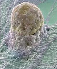 cellula staminale phsc cellule cordone ombelicale