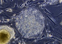 Cellule Staminali