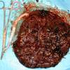 placenta e cordone ombelicale