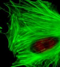 malattie autoimmuni aids hiv