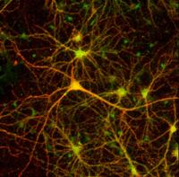 neuroni cellule cerebrali