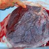 placenta