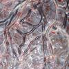 placenta sacco amniotico