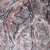 placenta e sacco amniotico