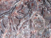placenta e sacco amniotico