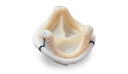 valvola porcina calcificazione