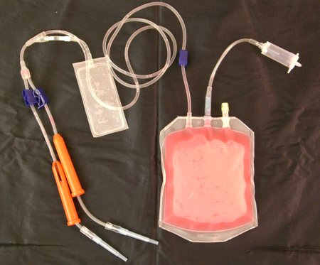 kit cellule staminali sangue cordone ombelicale
