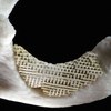 scaffold mandibola