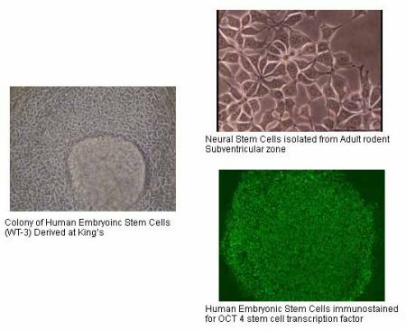 cellule malattie neurodegenerative