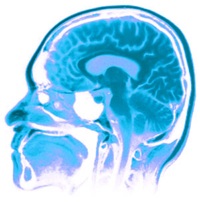mri cervello