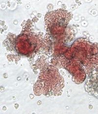cellule staminali cordone ombelicale