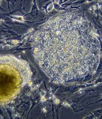 colonia cellule staminali
