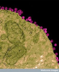 virus hiv cellula aids