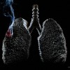 cancro_polmoni_fumo