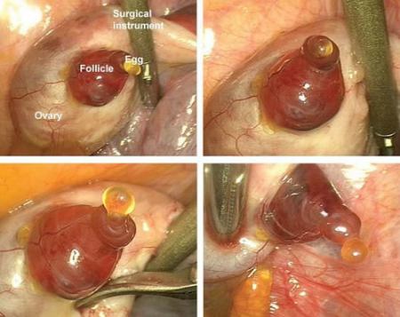 ovulazione ovulo umano