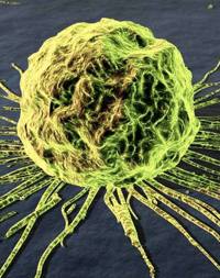 cellula cancerogena cancro tumore