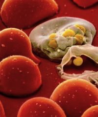 cellula hiv virus