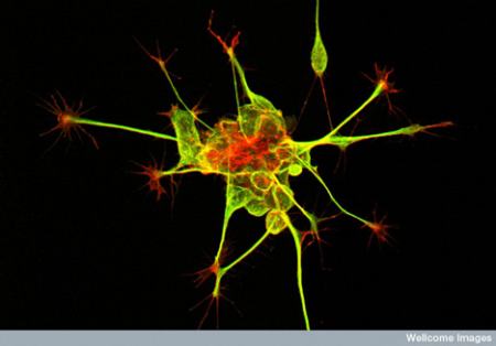 cellule neurone staminali