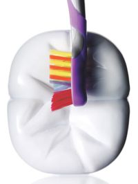 pulizia denti carie