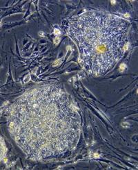 cellule staminali