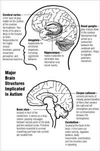 Image Result For Sindrome Di Asperger Image Result For Sindrome Di Asperger