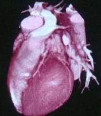 cuore cellule staminali