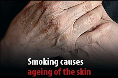 invecchiamento pelle sigarette fumo